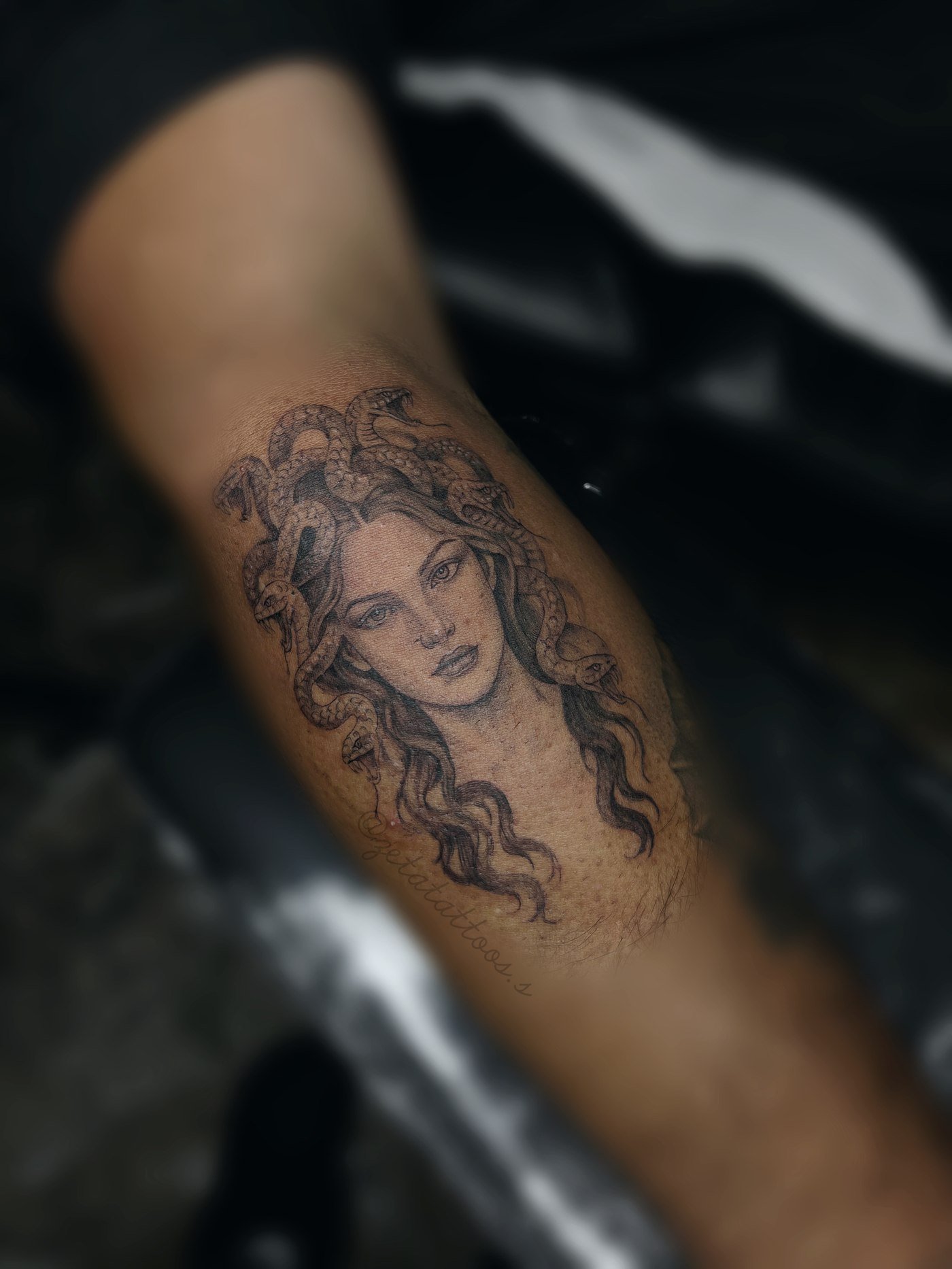 Medusa